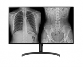 LG 32" (16:9) 8MP IPS DIAGNOSTIC, 450CD, HDMI, DP, DICOM, CLINICAL PATHOLOGY, 5YR WTY